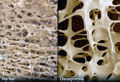 Webmd rm photo of porous bones.jpg